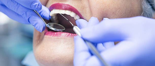Best Root Canal Emergency Dentist  in Ellisville, MS